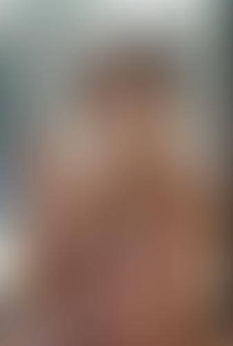 Geblurrte Content-Vorschau