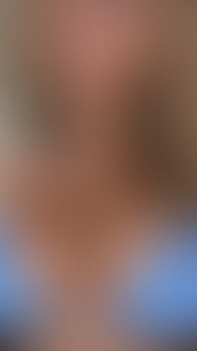 Geblurrte Content-Vorschau