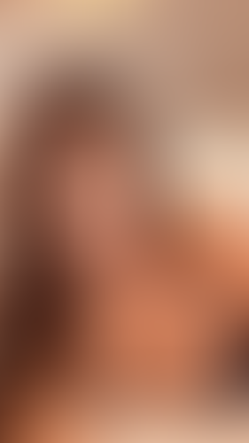 Geblurrte Content-Vorschau