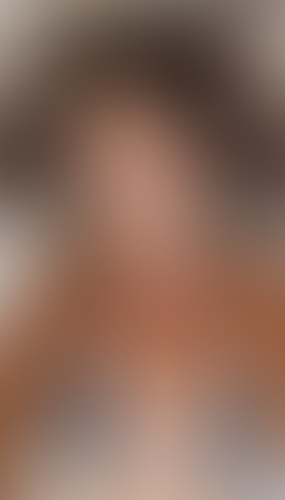 Geblurrte Content-Vorschau