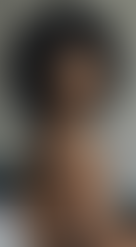 Geblurrte Content-Vorschau
