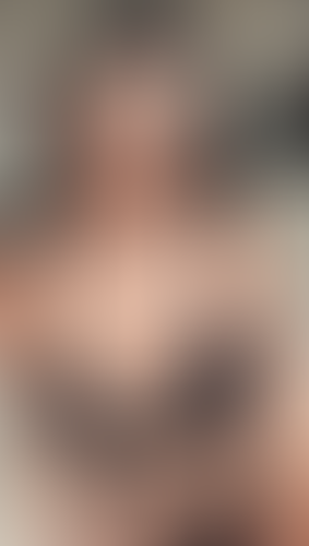 Geblurrte Content-Vorschau