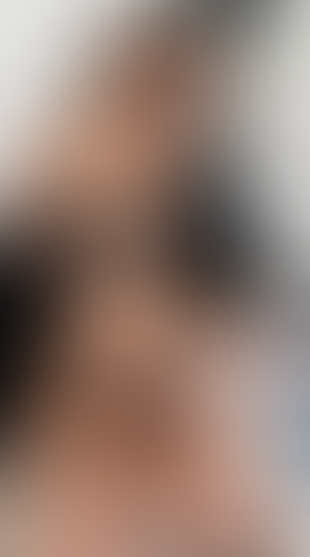 Geblurrte Content-Vorschau