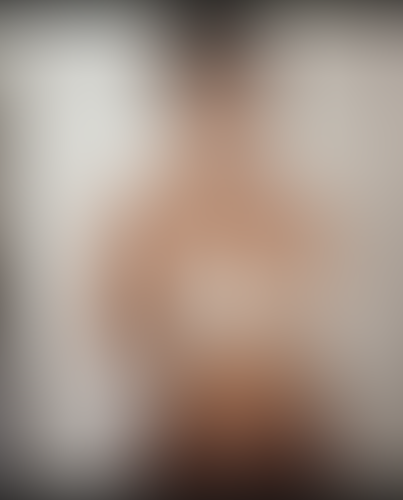 Geblurrte Content-Vorschau