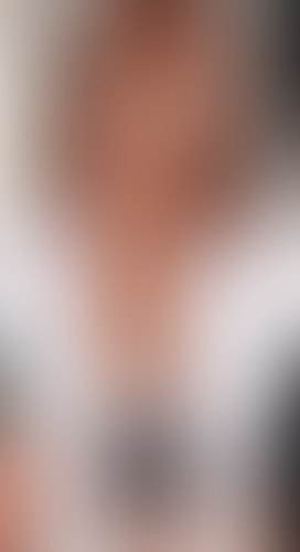 Geblurrte Content-Vorschau