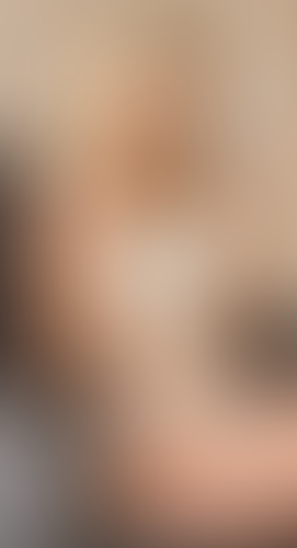Geblurrte Content-Vorschau