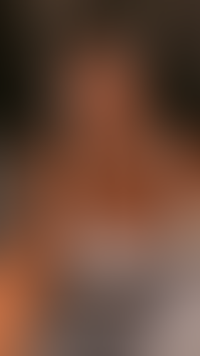 Geblurrte Content-Vorschau