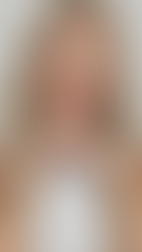 Geblurrte Content-Vorschau