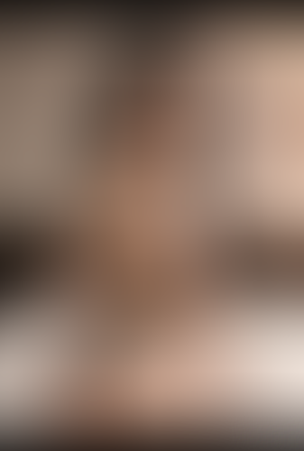 Geblurrte Content-Vorschau