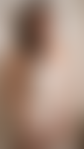 Geblurrte Content-Vorschau