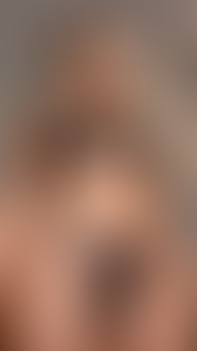 Geblurrte Content-Vorschau