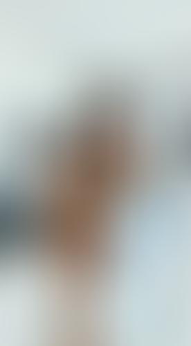 Geblurrte Content-Vorschau