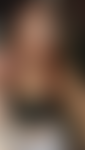 Geblurrte Content-Vorschau