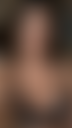 Geblurrte Content-Vorschau