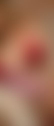 Geblurrte Content-Vorschau