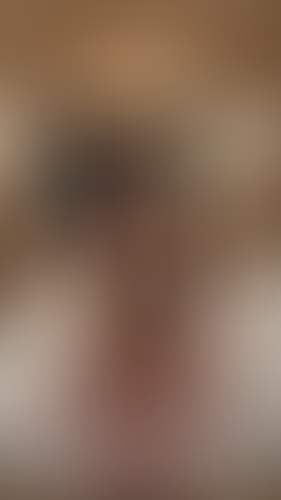 Geblurrte Content-Vorschau