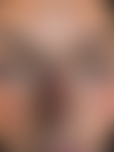 Geblurrte Content-Vorschau
