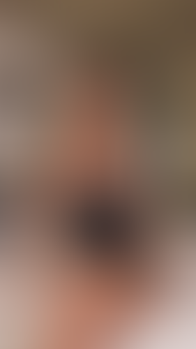 Geblurrte Content-Vorschau