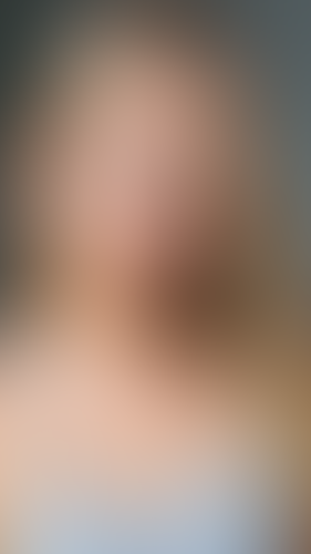Geblurrte Content-Vorschau
