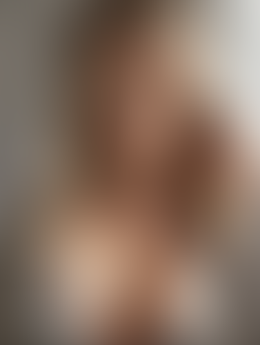 Geblurrte Content-Vorschau