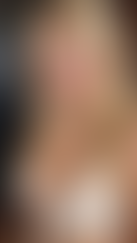 Geblurrte Content-Vorschau