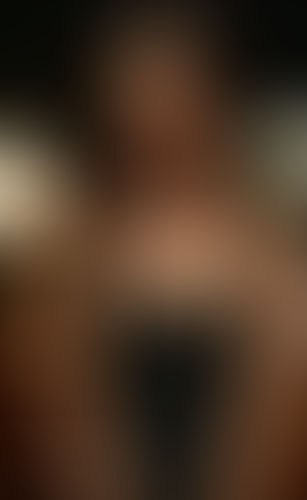 Geblurrte Content-Vorschau