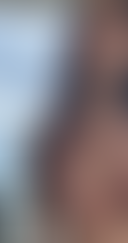 Geblurrte Content-Vorschau