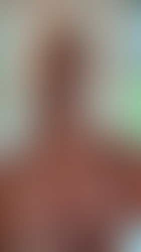 Geblurrte Content-Vorschau