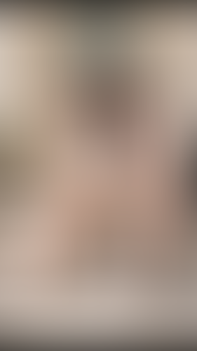 Geblurrte Content-Vorschau
