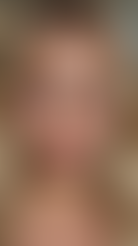 Geblurrte Content-Vorschau