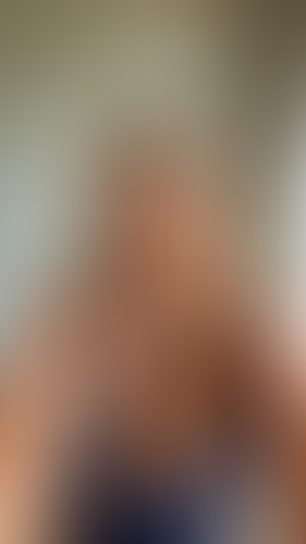 Geblurrte Content-Vorschau