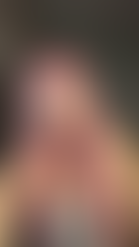 Geblurrte Content-Vorschau