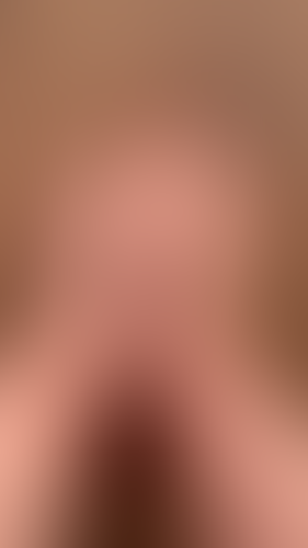 Geblurrte Content-Vorschau