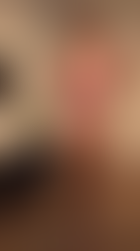 Geblurrte Content-Vorschau