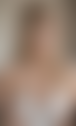 Geblurrte Content-Vorschau