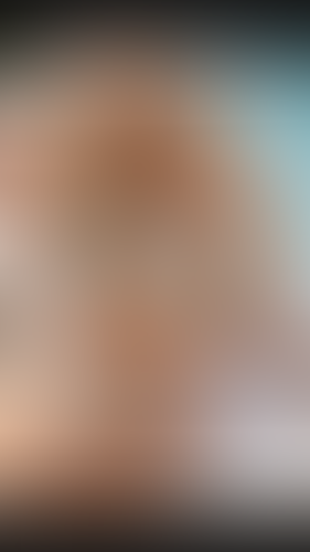 Geblurrte Content-Vorschau