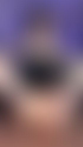 Geblurrte Content-Vorschau