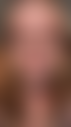 Geblurrte Content-Vorschau