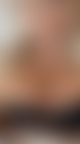 Geblurrte Content-Vorschau