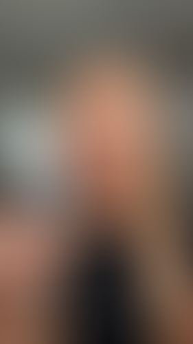 Geblurrte Content-Vorschau
