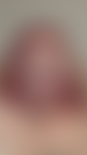 Geblurrte Content-Vorschau