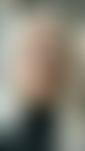 Geblurrte Content-Vorschau