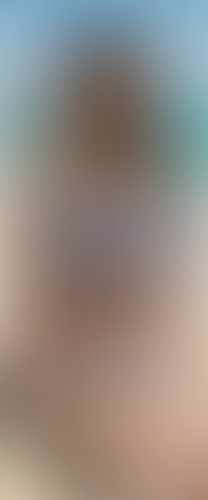 Geblurrte Content-Vorschau