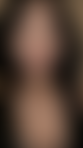 Geblurrte Content-Vorschau