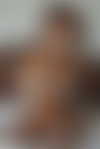 Geblurrte Content-Vorschau