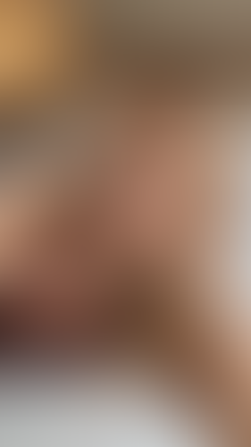 Geblurrte Content-Vorschau