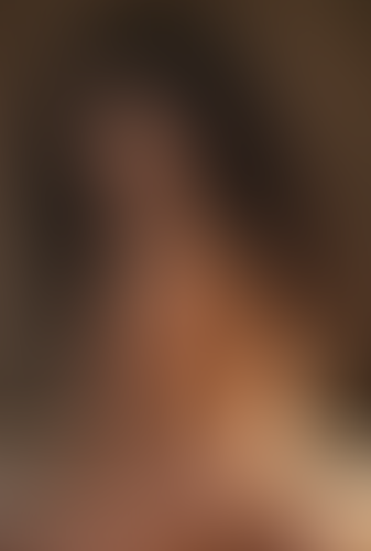 Geblurrte Content-Vorschau