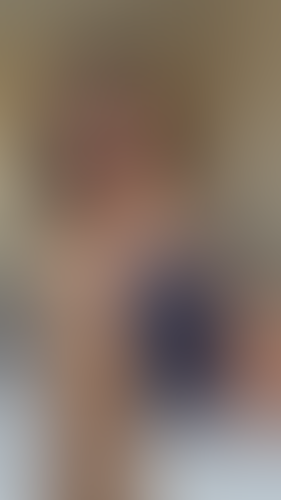 Geblurrte Content-Vorschau