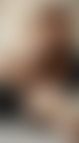 Geblurrte Content-Vorschau
