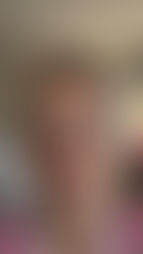 Geblurrte Content-Vorschau